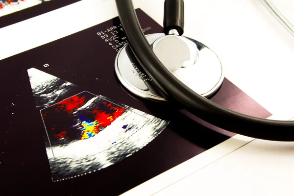 Hart scan examenuitslag met een stethoscoop — Stockfoto