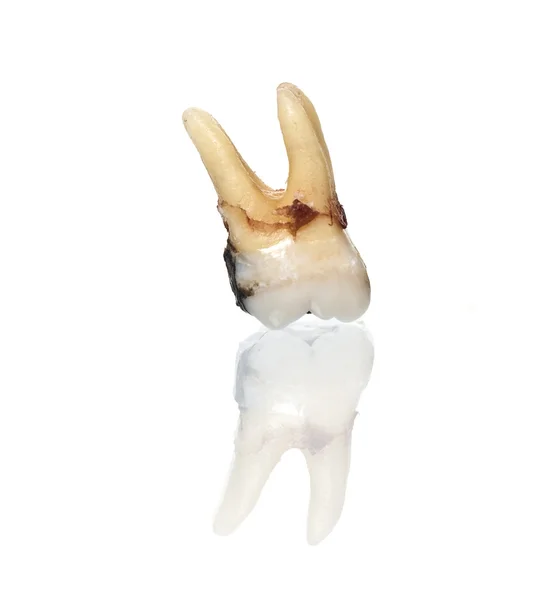 Wyodrębnione zepsutych zębów — Zdjęcie stockowe