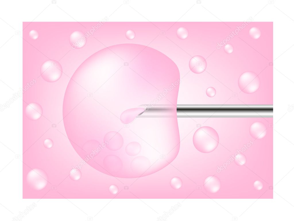 In vitro fertilization process
