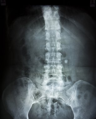 X-ray film clipart
