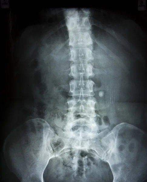 Röntgenfilm Stockbild