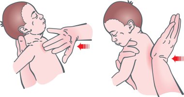 Infant resuscitation clipart