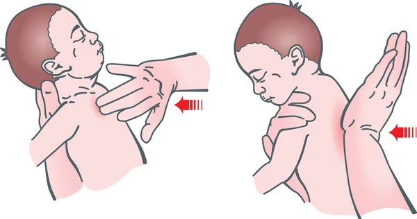Wiederbelebung von Säuglingen — Stockvektor