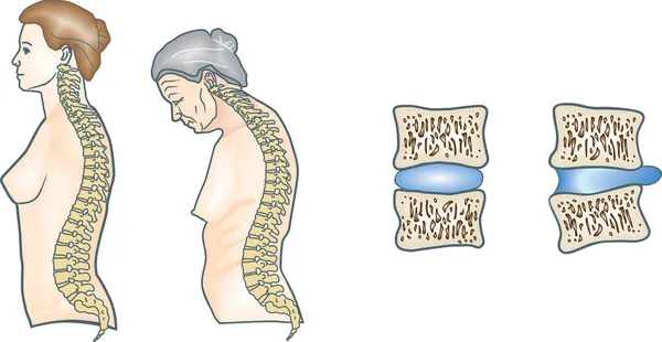 Colonna vertebrale umana — Vettoriale Stock