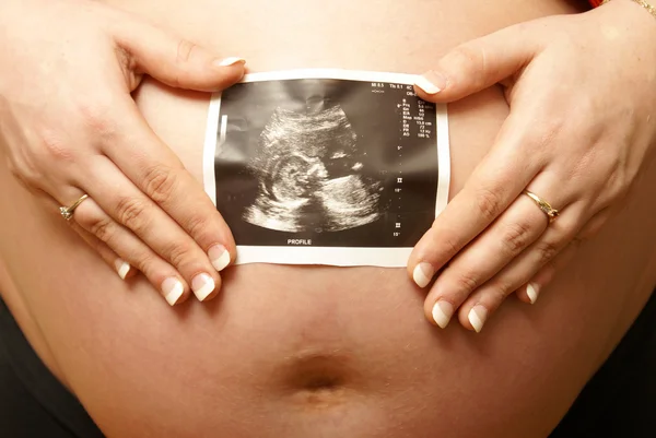 Mother and her Babies Sonogram — Stock Photo, Image