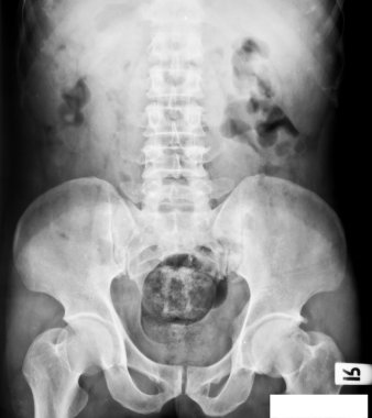 X-ray koleksiyonu