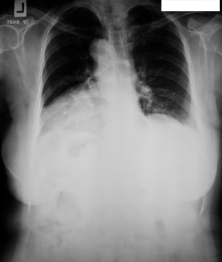 X-ray koleksiyonu