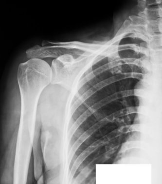 X-ray koleksiyonu