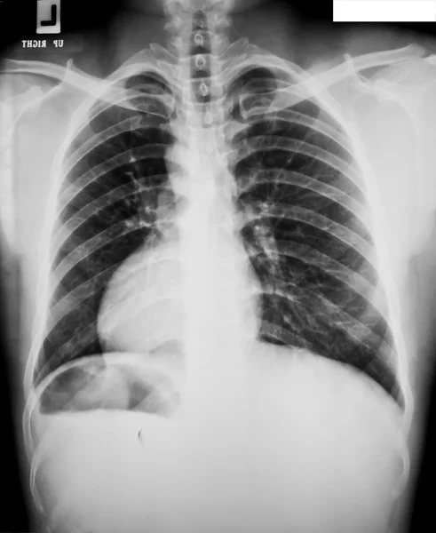 X-ray 컬렉션 — 스톡 사진