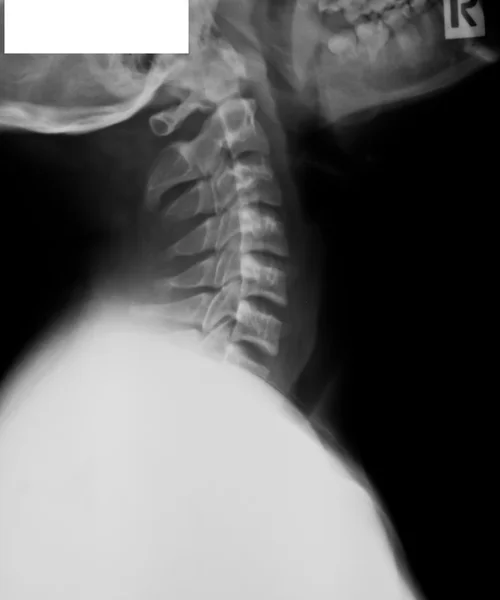 Collection of x-ray — Stock Photo, Image