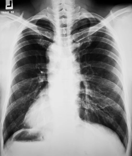stock image Collection of x-ray