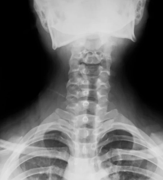 Коллекция рентгеновских лучей — стоковое фото
