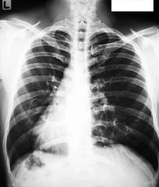 Verzameling van röntgenstralen — Stockfoto