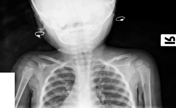 Insamling av röntgenbilder — Stockfoto