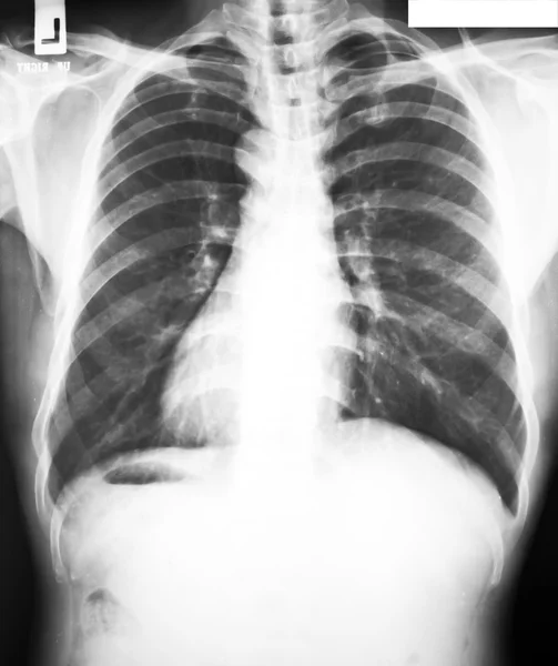 Sammlung von Röntgenaufnahmen — Stockfoto