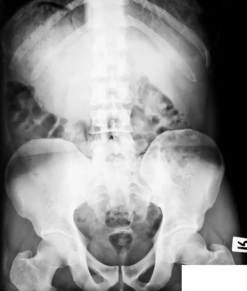 Insamling av röntgenbilder — Stockfoto