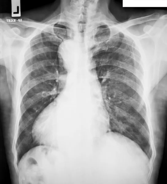 Verzameling van röntgenstralen — Stockfoto