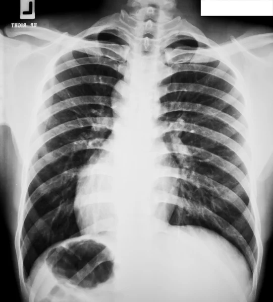 Sammlung von Röntgenaufnahmen — Stockfoto