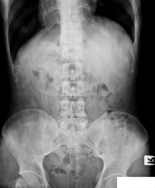X-ray koleksiyonu — Stok fotoğraf