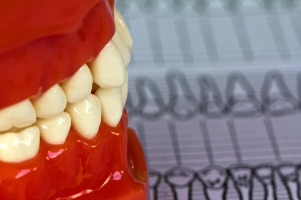 Outils et équipements dentaires sur le tableau dentaire — Photo