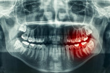 Panoramic dental xray clipart