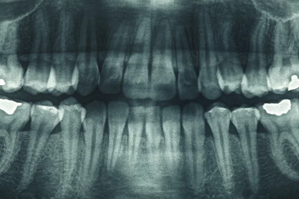Raio-x dental panorâmico — Fotografia de Stock