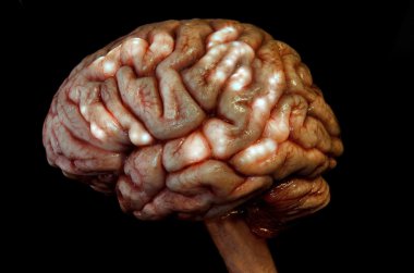 insan beyin ve omurga lateral