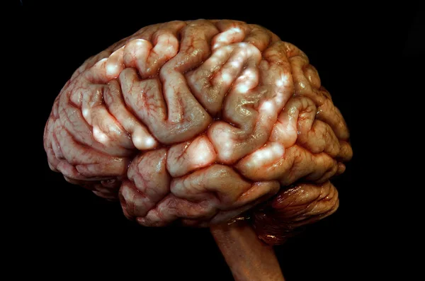 stock image Human brain and spine lateral