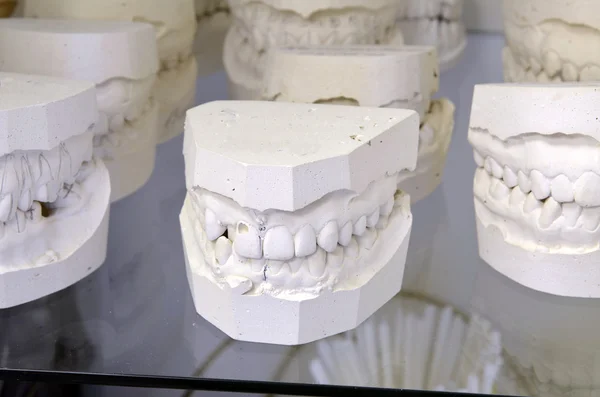 stock image Dental models