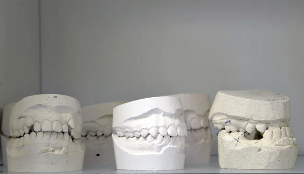 stock image Dental models