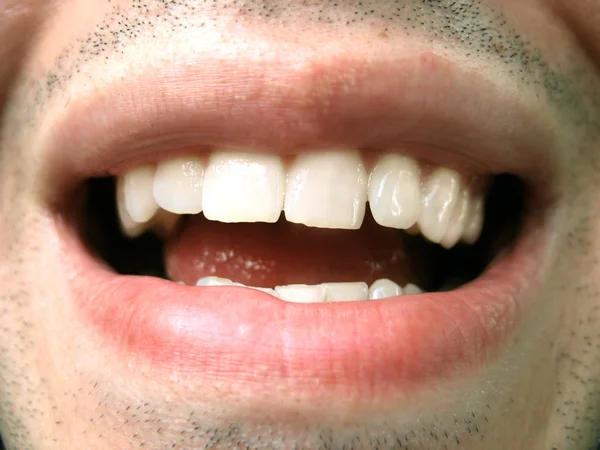Szczęśliwy usta — Zdjęcie stockowe