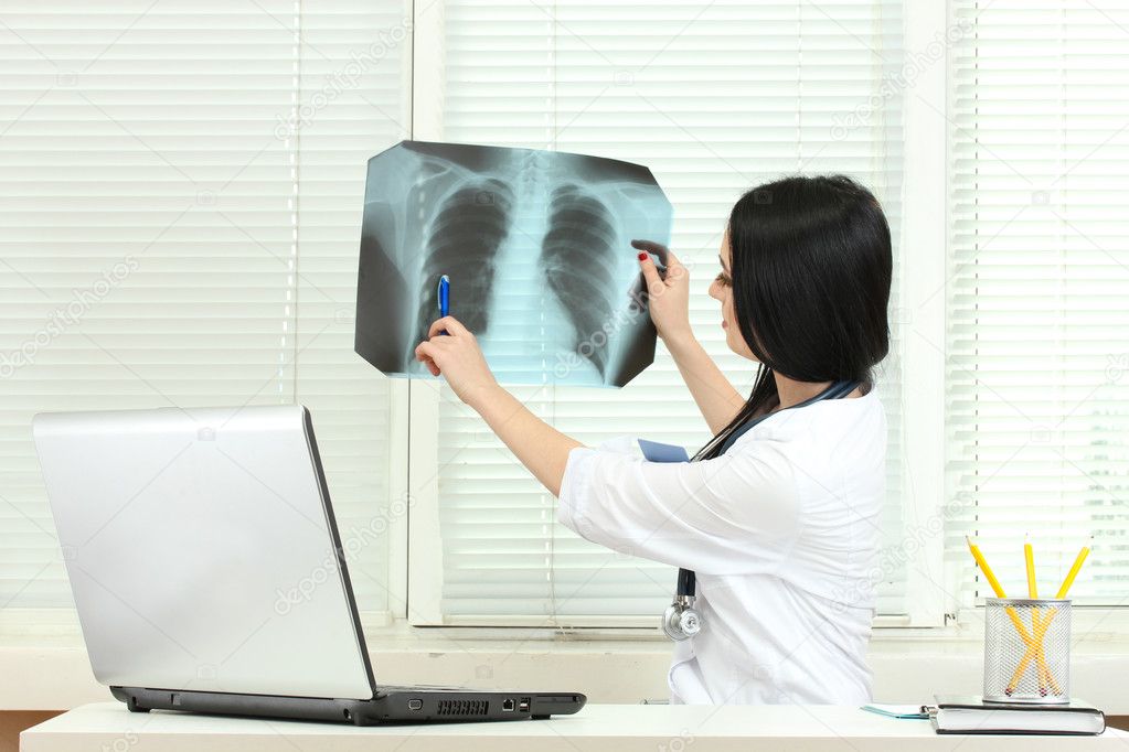 Beautiful girl doctor holding X-ray in the office