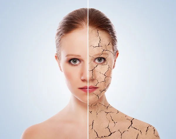 Concept of cosmetic effects, treatment and skin care. face of y — Stock Photo, Image
