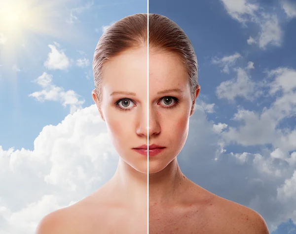 Effect of healing of skin, beauty young woman before and after t — Stock Photo, Image