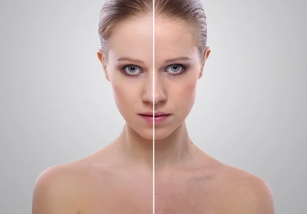 Efecto de la curación de la piel, belleza mujer joven antes y después t —  Fotos de Stock