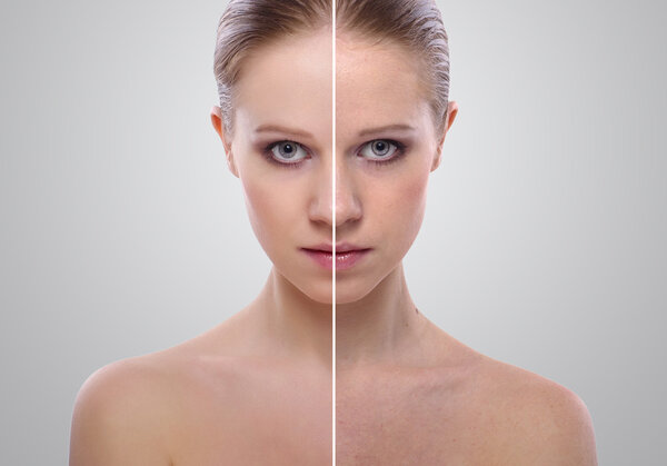 Эффект исцеления кожи, красоты молодой женщины до и после t
