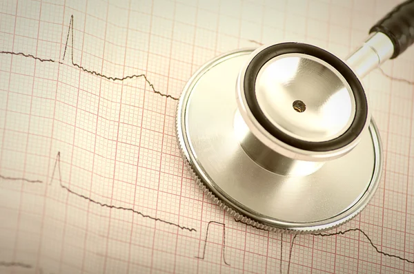 stock image Part of medical stethoscope and electrocardiogram (ECG) close up