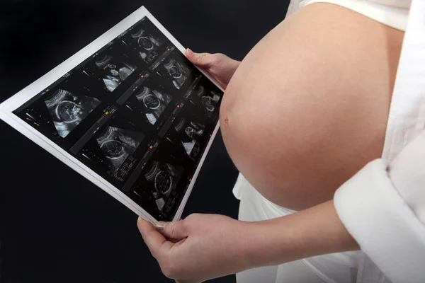 Беременная женщина смотрит на ультразвук — стоковое фото