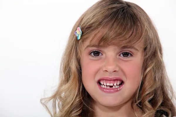 Malá holčička vycenil zuby — Stock fotografie