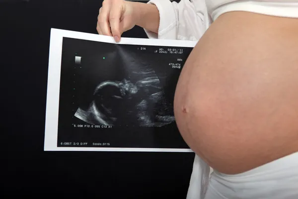 Szülészeti ultrahangot tartó nő a hasa mellett — Stock Fotó