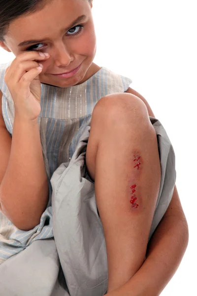 Menina com lesão na perna — Fotografia de Stock