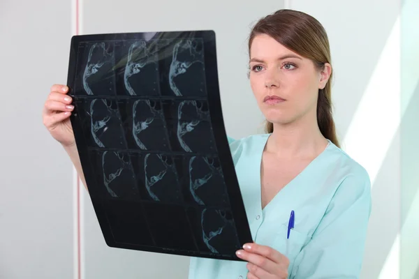 Kvinnlig sjuksköterska hålla röntgenbilden — Stockfoto