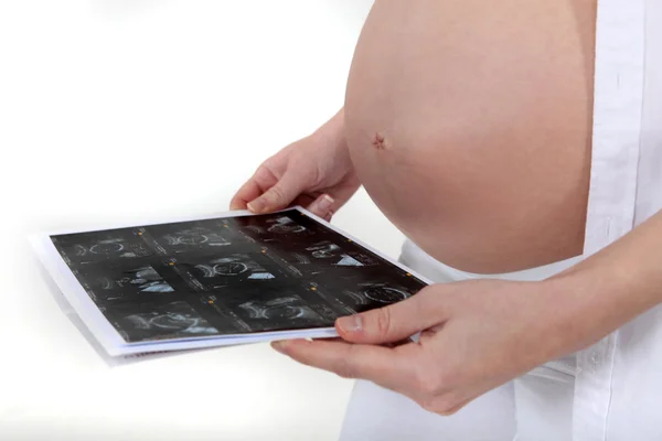 Uma mulher grávida olhando para sua ecografia. — Fotografia de Stock