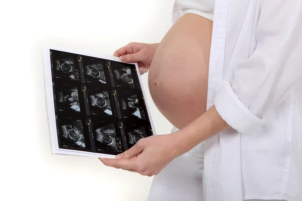 Schwangere beobachtet ihren Scan — Stockfoto