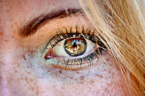 Поврежденные солнцем веснушки на коже глаза hdr — стоковое фото