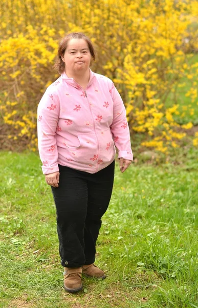 Down syndrome woman — Stock Photo, Image