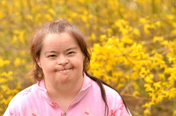 다운 증후군 여자 — 스톡 사진