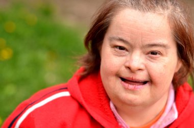 Down syndrome woman clipart