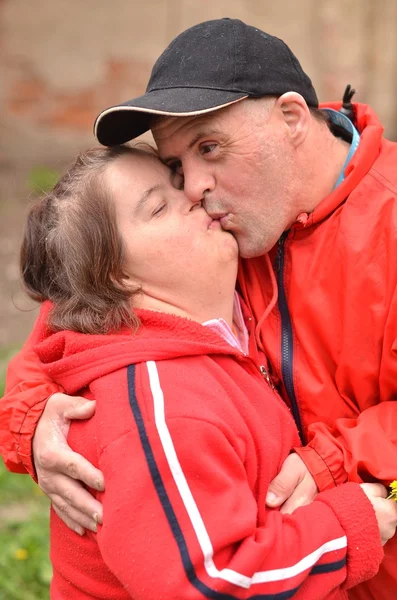 Casal síndrome de Down — Fotografia de Stock