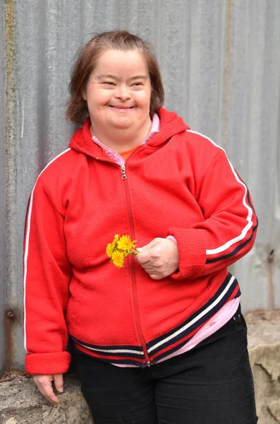 다운 증후군 여자 부 민들레 — 스톡 사진